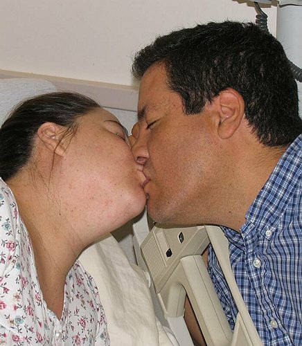 kiss